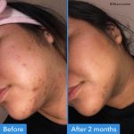GOOD MOLECULES DISCOLOURATION CORRECTING SERUM 30ml - Image 3