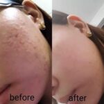 SOME BY MI SNAIL TRUECICA MIRACLE REPAIR STARTER KIT - Image 4