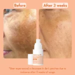 WishCare Super Bright Vitamin C16 Serum 30ml - Image 3