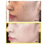 SOME BY MI YUJA NIACIN ANTI BLEMISH SERUM 50ML - Image 4