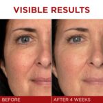 L’Oreal Paris Revitalift Triple Power Anti-Aging Face Moisturizer - Image 2