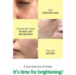 SOME BY MI YUJA NIACIN ANTI BLEMISH SERUM 50ML - Image 3