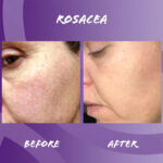 Edible Health Hydrolysed Bovine Collagen Powder – 400gm - Image 2