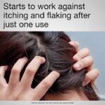 Neutrogena T/Gel Therapeutic Shampoo 250ml - Image 4