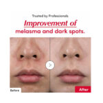 EQQUALBERRY VITAMIN ILLUMINATING SERUM 30ML - Image 4