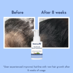 WishCare Hair Growth Serum 30ml - Image 3