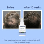 WishCare Hair Growth Serum 30ml - Image 4