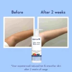 WishCare AHA + BHA Body Lotion – 200ml - Image 2