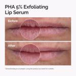 The Ordinary PHA 5% Exfoliating Lip Serum 15ml – Gentle Lip Exfoliation for Soft, Smooth & Hydrated Lips - Image 4