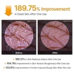 Dr.Melaxin Body Keratin Care Kojic Acid Turmeric Spray - Image 4