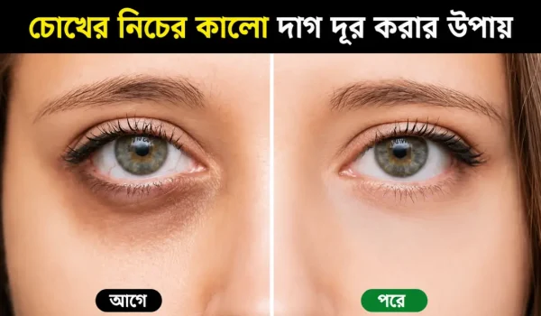 চোখের নিচের কালো দাগ দূর করার উপায়: ১০টি ধাপের গাইড
