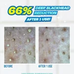 Jumiso Blackhead Melting Softener 150ml