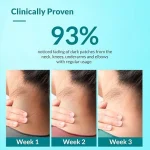FIXDERMA Nigrifix Cream for Acanthosis Nigricans with Lactic Acid 50ml - Image 6